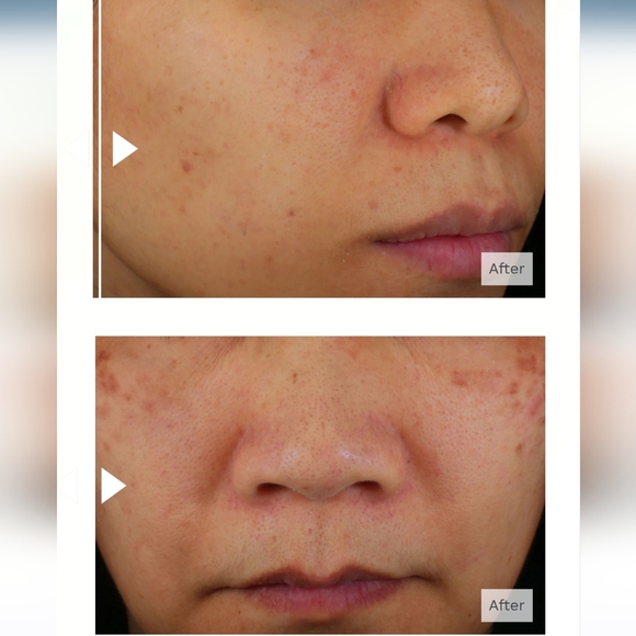 Acaderma's The Oasis Barrier Booster Serum x2 - Picture 9 of 12